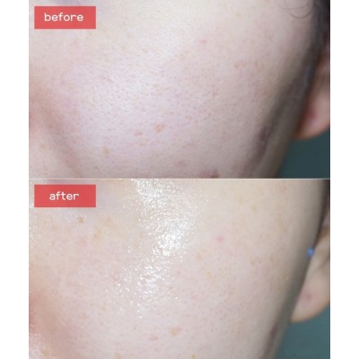 Премиальная ампульная сыворотка для лица укрепляющая с золотом Medi-Peel Luxury 24K Gold Ampoule, 100мл Премиальная ампульная сыворотка для лица укрепляющая с золотом Medi-Peel Luxury 24K Gold Ampoule, 100мл