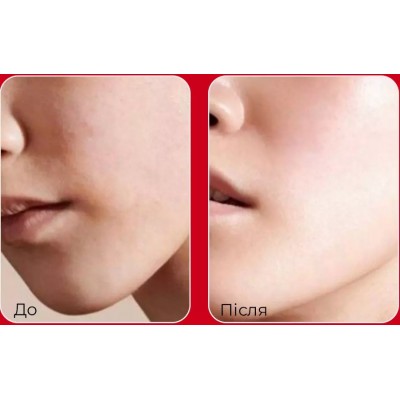 Солнцезащитный крем для лифтинга пор Medi-Peel Red Lacto Collagen Pore Lifting Sun Cream 50g Солнцезащитный крем для лифтинга пор Medi-Peel Red Lacto Collagen Pore Lifting Sun Cream 50g