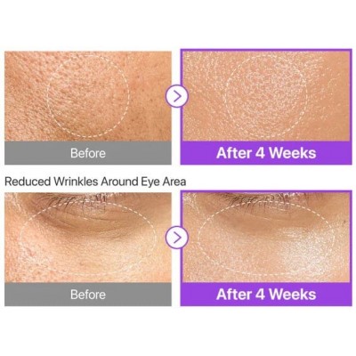 Антивікова ліфтинг-есенція для обличчя Numbuzin No.9 NAD Bio Lifting Essence 50ml Антивікова ліфтинг-есенція для обличчя Numbuzin No.9 NAD Bio Lifting Essence 50ml