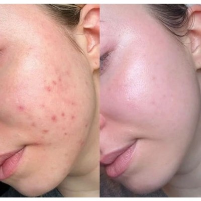 Тонер-педи для обличчя з саліциловою кислотою Dr. Althea 2% Salicylic Acid Clear Pad, 60шт Тонер-педи для обличчя з саліциловою кислотою Dr. Althea 2% Salicylic Acid Clear Pad, 60шт