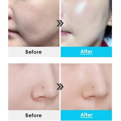 Крем для лица капсульный в шариках интенсивно увлажняющий Medi-Peel Power Aqua Cream 50мл Крем для лица капсульный в шариках интенсивно увлажняющий Medi-Peel Power Aqua Cream 50мл