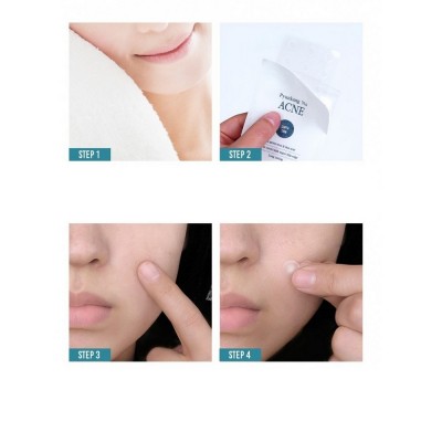 Пластирі для обличчя від запалень Pyunkang Yul Acne Spot Patch Super Thin 15 шт
