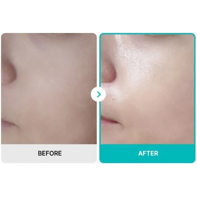 Успокаивающая маска для лица с c-PDRN Rejuran Turnover Mask, 40ml