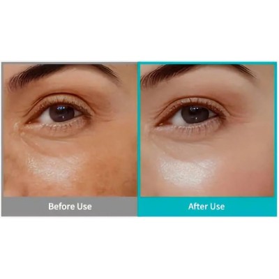 Интенсивный крем для кожи вокруг глаз Rejuran Intensive Eye Cream, 20ml Интенсивный крем для кожи вокруг глаз Rejuran Intensive Eye Cream, 20ml