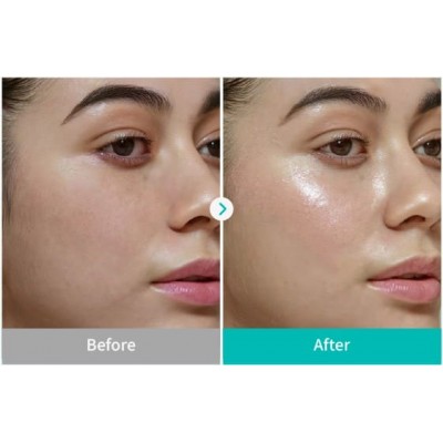 Тонер для восстановления баланса кожи лица Rejuran Rebalancing Toner, 120ml Тонер для восстановления баланса кожи лица Rejuran Rebalancing Toner, 120ml