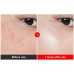 Антивіковий крем для обличчя нового покоління Centellian24 Madeca Cream Time Reverse Zero Season7, 80ml