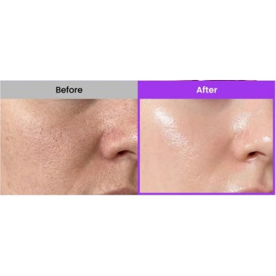 Сыворотка-мист с чёрной икрой и PDRN для сияния и упругости кожи Biodance Caviar PDRN Jelly Serum Mist, 50ml Сыворотка-мист с чёрной икрой и PDRN для сияния и упругости кожи Biodance Caviar PDRN Jelly Serum Mist, 50ml
