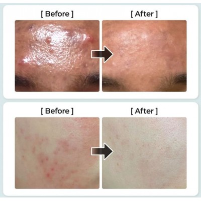 Успокаивающий тонер для лица с центеллой азиатской Numbuzin No.1 Pure-full Calming Herb Toner 300ml Успокаивающий тонер для лица с центеллой азиатской Numbuzin No.1 Pure-full Calming Herb Toner 300ml