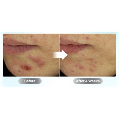 Успокаивающая сыворотка для лица Numbuzin №1 Pantothenic B5 Active Soothing Serum, 50ml Успокаивающая сыворотка для лица Numbuzin №1 Pantothenic B5 Active Soothing Serum, 50ml