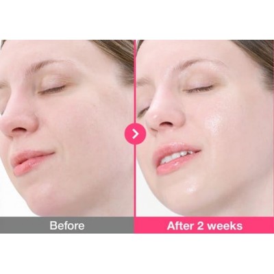 Сыворотка для упругости кожи с PDRN и коллагеном Numbuzin №2 Rose PDRN Collagen Plumping Serum, 30ml Сыворотка для упругости кожи с PDRN и коллагеном Numbuzin №2 Rose PDRN Collagen Plumping Serum, 30ml