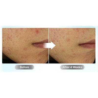 Успокаивающий крем для лица Numbuzin №1 Pantothenic B5 Active Soothing Cream, 80ml Успокаивающий крем для лица Numbuzin №1 Pantothenic B5 Active Soothing Cream, 80ml