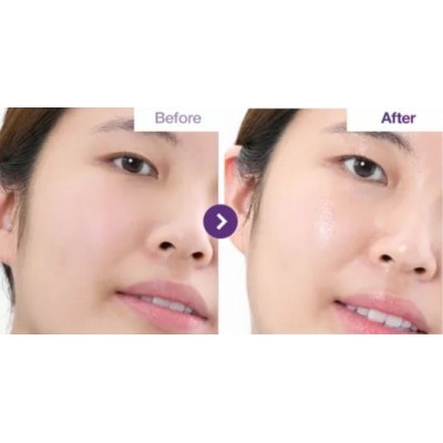 Восстанавливающий тонер для лица с PDRN и пептидами Numbuzin №9 NAD PDRN Glow Boosting Toner, 150ml Восстанавливающий тонер для лица с PDRN и пептидами Numbuzin №9 NAD PDRN Glow Boosting Toner, 150ml