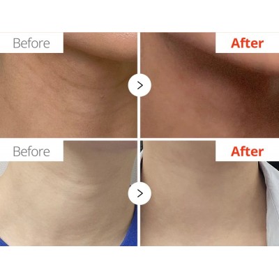 Антивікова сироватка для шиї Dr. Melaxin Necksphalt ECM Barrier Ampoule, 1.5ml Антивікова сироватка для шиї Dr. Melaxin Necksphalt ECM Barrier Ampoule, 1.5ml