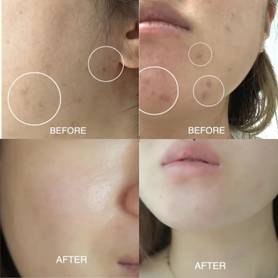 Сыворотка для смягчения лица Numbuzin №3 Skin Softening Serum, 50ml Сыворотка для смягчения лица Numbuzin №3 Skin Softening Serum, 50ml