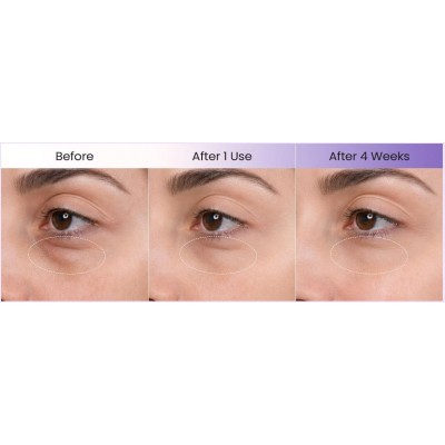 Крем для кожи вокруг глаз с экстрактом икры и  PDRN лосося Biodance Caviar PDRN Eye Cream, 30ml