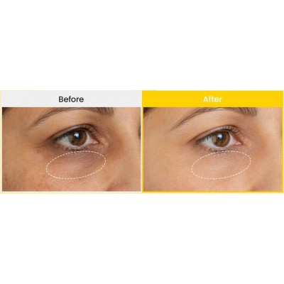 Крем для кожи вокруг глаз с ниацинамидом Biodance Vita Niacinamide Eye Cream, 30ml