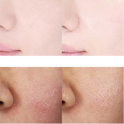 Увлажняющий двухфазный кремовый мист для лица Dr. Althea 345 Relief Cream Mist, 60ml