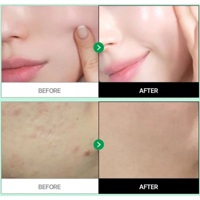 Заспокійливий крем-гель для обличчя Parnell Cicamanu Gel Cream, 10 мл