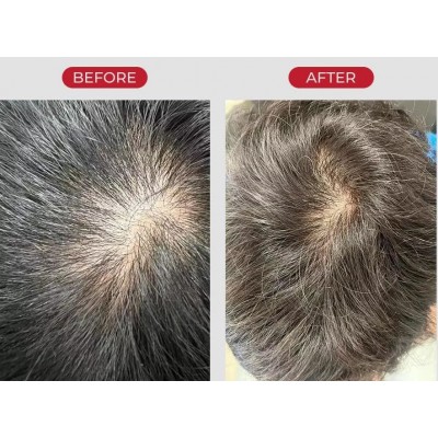 Зміцнюючий шампунь для об'єму волосся Moev Annurcatin Shampoo Sachet, 8ml Зміцнюючий шампунь для об'єму волосся Moev Annurcatin Shampoo Sachet, 8ml