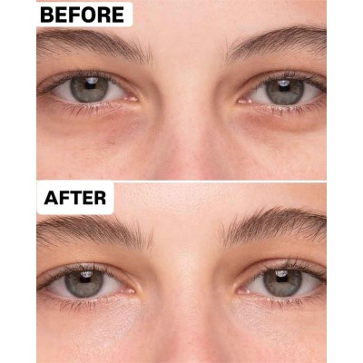 Сыворотка для кожи вокруг глаз Dr. Althea To Be Yothfull Eye Serum, 25ml