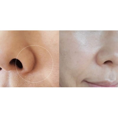 Антивозрастная сыворотка-бустер для лица Skin 1004 Madagascar Centella Matrixyl 10 Boosting Shot Ampoule Sachet 1.5ml