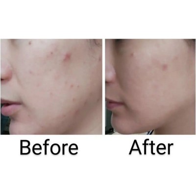 Ампульная успокаивающая сыворотка для лица с центеллой азиатской Skin 1004 Madagascar Centella Ampoule 100ml Ампульная успокаивающая сыворотка для лица с центеллой азиатской Skin 1004 Madagascar Centella Ampoule 100ml