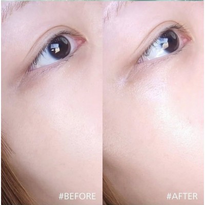 Увлажняющая сыворотка для лица с полинуклеотидами и гиалуроновой кислотой Anua PDRN Hyaluronic Acid Capsule 100 Serum, 30ml