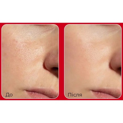 Пилинг-пэды для ухода за порами Medi-Peel Lacto Pore Lifting Pad 2x, 50шт