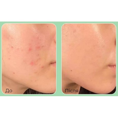 Охлаждающие успокаивающие пэды для лица Medi-Peel Cica Cooling Calming Pad 2x, 50шт