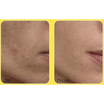 Тонізуючі вітамінні педи для обличчя Medi-Peel Vitamin Mela Toning Pad 2x, 50шт