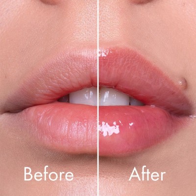 Плампер для губ с микроиглами VT Cosmetics Reedle Shot Lip Plumper Beginner, 4.3g