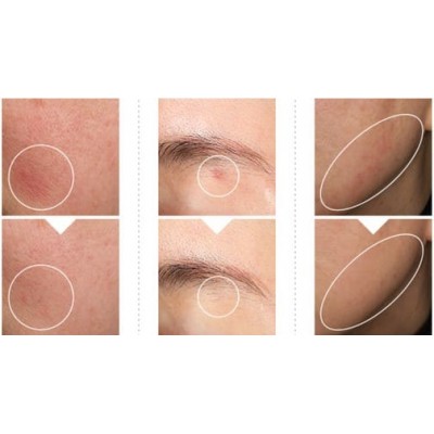 Сироватка для обличчя проти пігментації Anua Niacinamide 10 TXA 4 Serum, 30ml