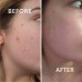 Гіалуронова сироватка для обличчя з азелаїновою кислотою Anua Azelaic Acid 10 Hyaluron Redness Soothing Serum, 30ml
