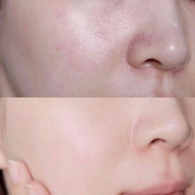Сировотка для обличчя Skin 1004 Madagascar Centella Hyalu-Cica Blue Serum, 50ml