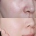 Сировотка для обличчя Skin 1004 Madagascar Centella Hyalu-Cica Blue Serum, 50ml