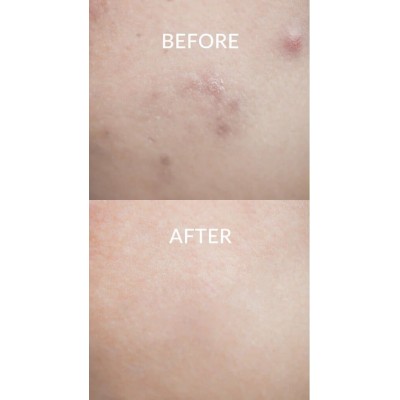 Заспокійливий крем для обличчя з азуленом Dr. Althea Pro Lab Azulene 147 HA-Intensive Soothing Cream, 50ml