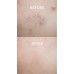 Заспокійливий крем для обличчя з азуленом Dr. Althea Pro Lab Azulene 147 HA-Intensive Soothing Cream, 50ml