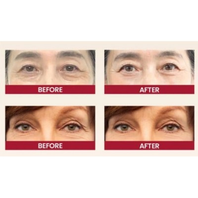 Крем для кожи вокруг глаз K-Secret SEOUL 1988 Eye Cream : Retinal Liposome 4% + Fermented Bean, 30ml