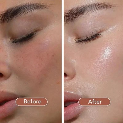 Восстанавливающая ампульная сыворотка для лица с пробиотиками Skin 1004 Madagascar Centella Probio-Cica Intensive Ampoule 50ml