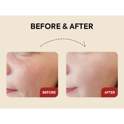 Сыворотка для лица K-Secret SEOUL 1988 Serum : Retinal Liposome 2% + Black Ginseng, 30ml