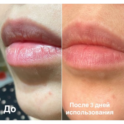 Увлажняющая сыворотка для губ с арбузом Manyo What A Melon Moisture Lip Serum, 10мл