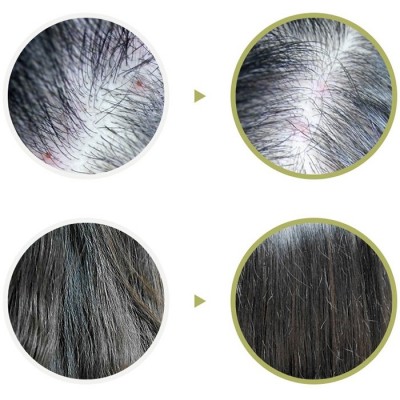 Сыворотка-пилинг для волос и кожи головы La'dor Scalp Scaling Spa Hair Ampoule, 15 мл